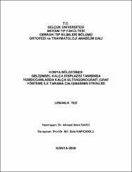 Küçük Resim